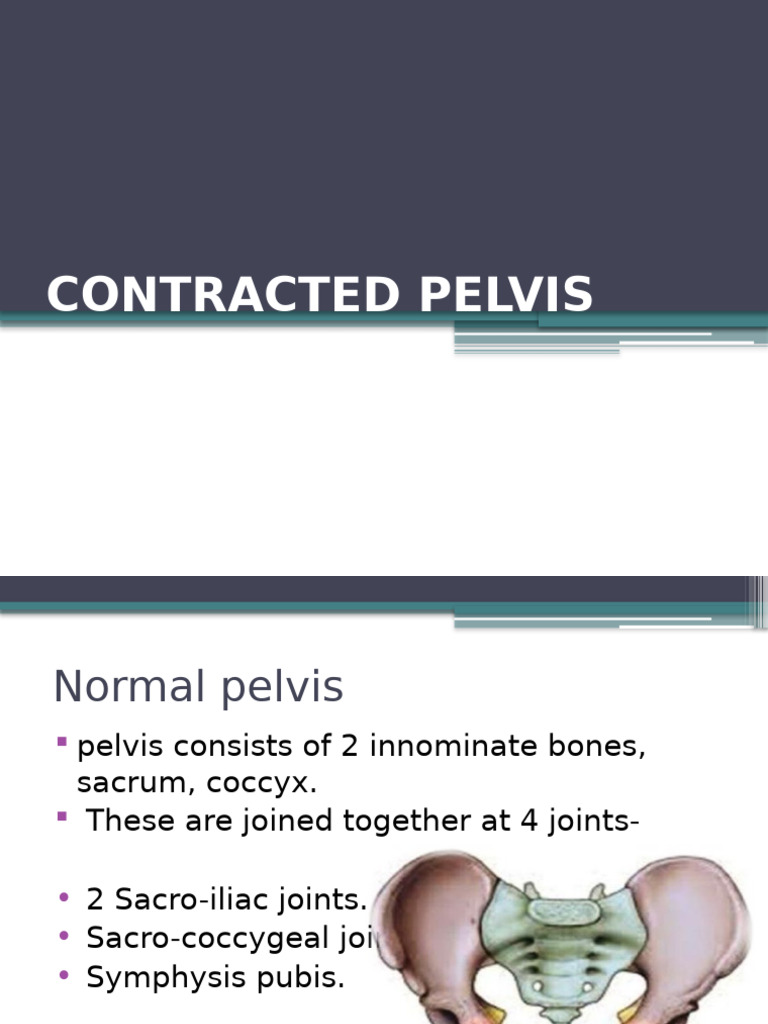 Robert's Pelvis: A Contracted Type | PDF | Pelvis | Skeletal System