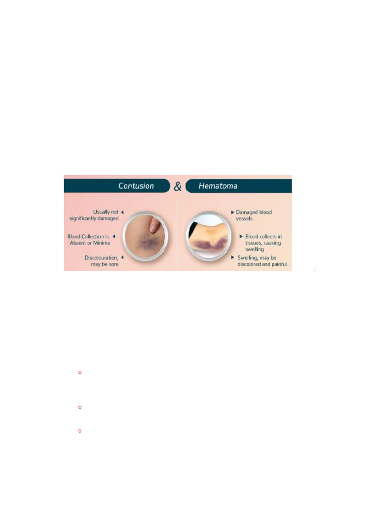 Contusions, Strains, and Sprains Guide | PDF | Joint | Bone