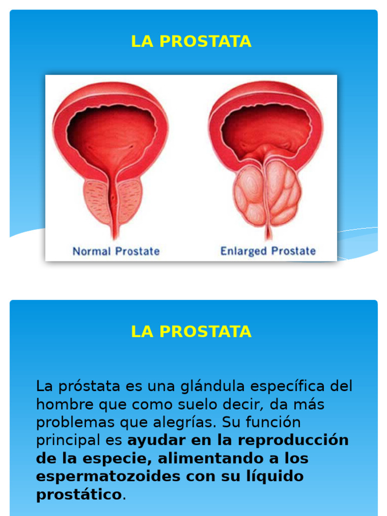 La Prostata | PDF