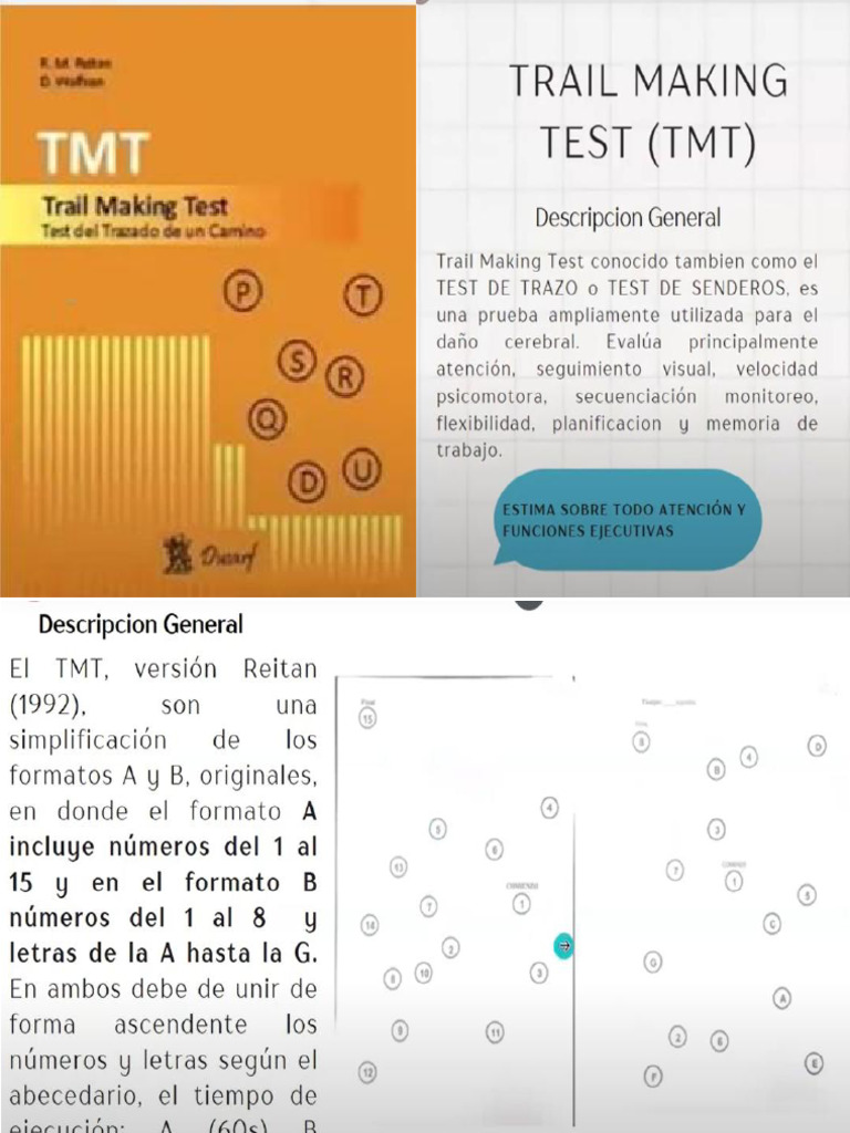 Manual Tmt. | PDF