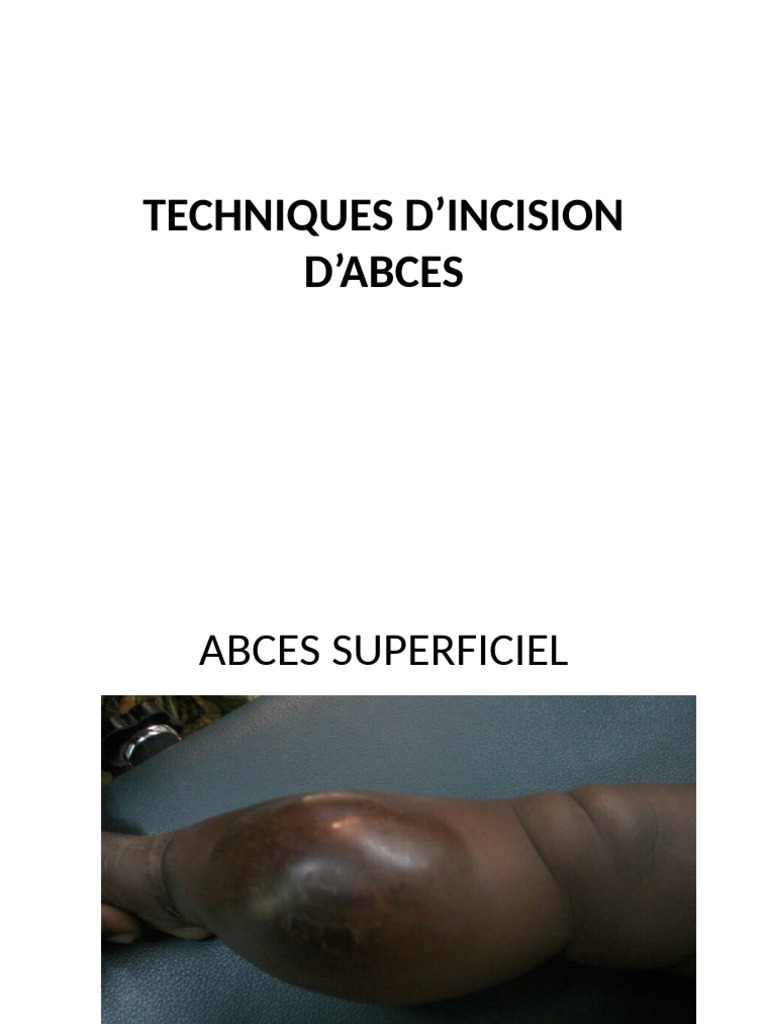 Techniques d'incision d'abscès médicaux | PDF