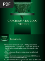 Carcinoma Do Colo Uterino