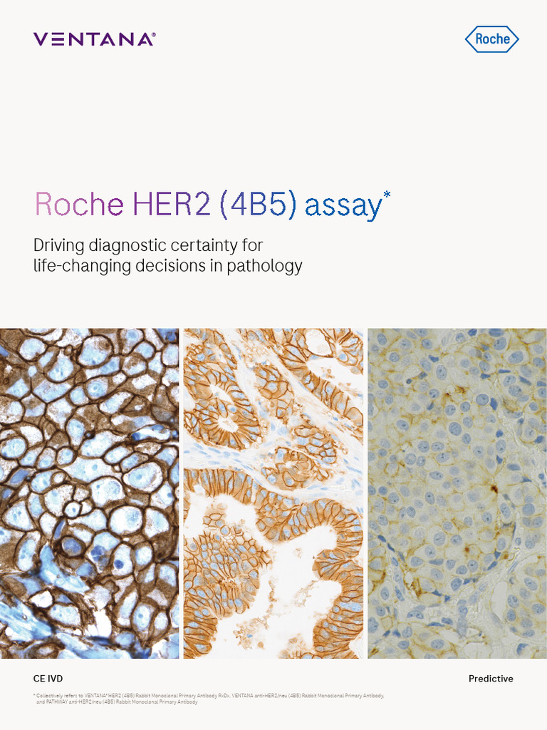 Roche HER2 (4B5) Assay for Cancer Diagnostics | PDF ...