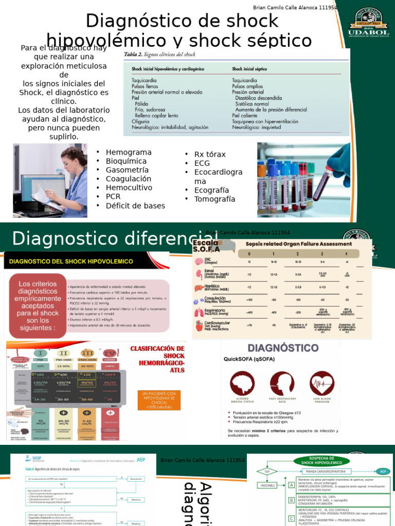 Diagnóstico de Shock Hipovolémico | PDF