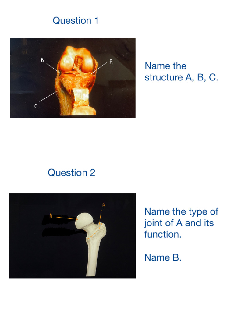 Anatomy and Joint Identification Quiz | PDF