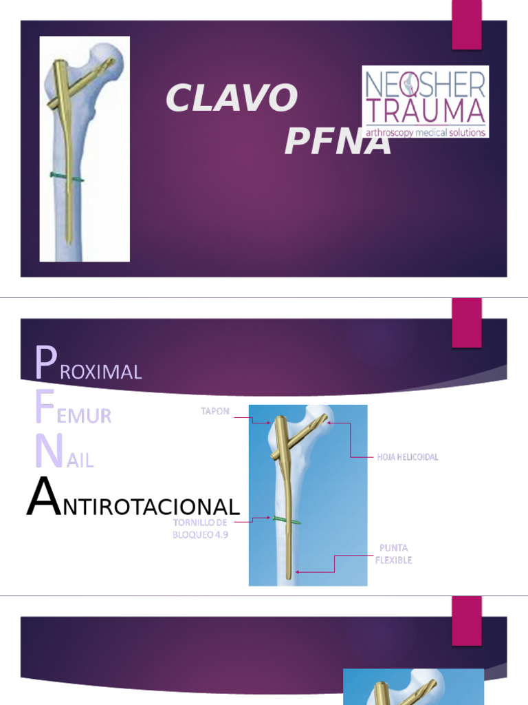 PFN Neo | PDF