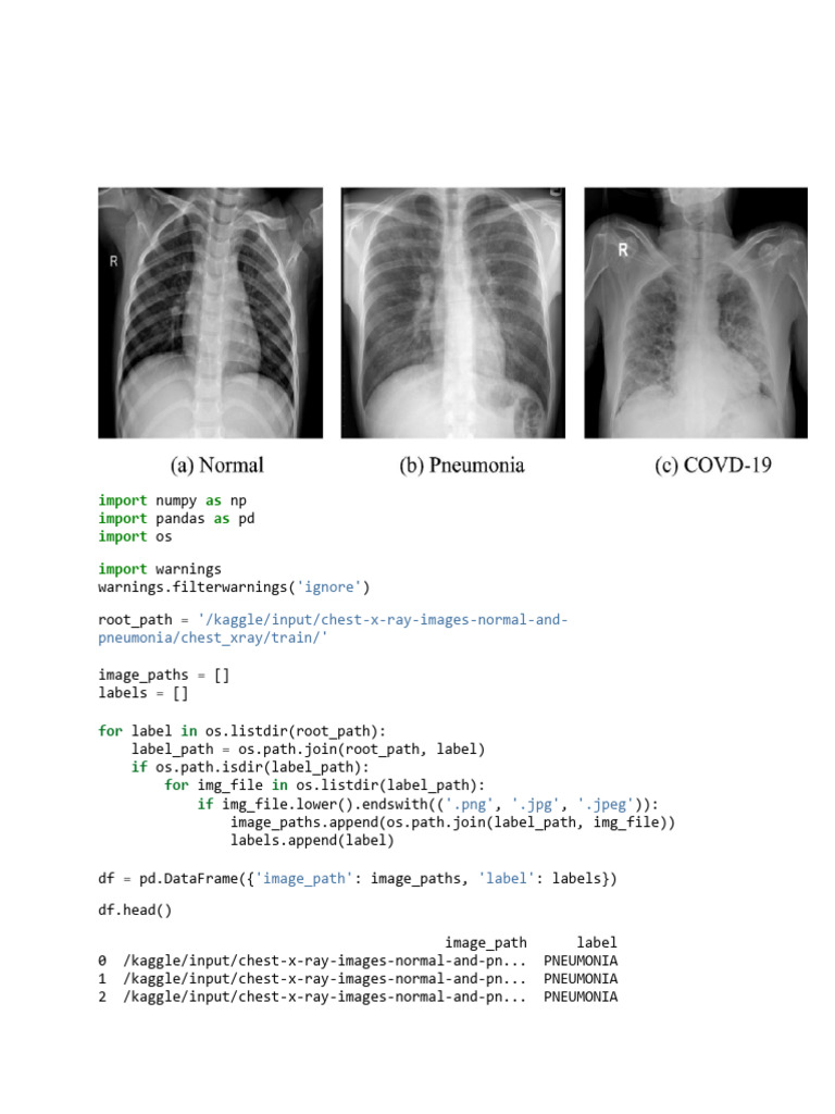 Chest X-Ray Image Classification Techniques | PDF | Statistical Data ...