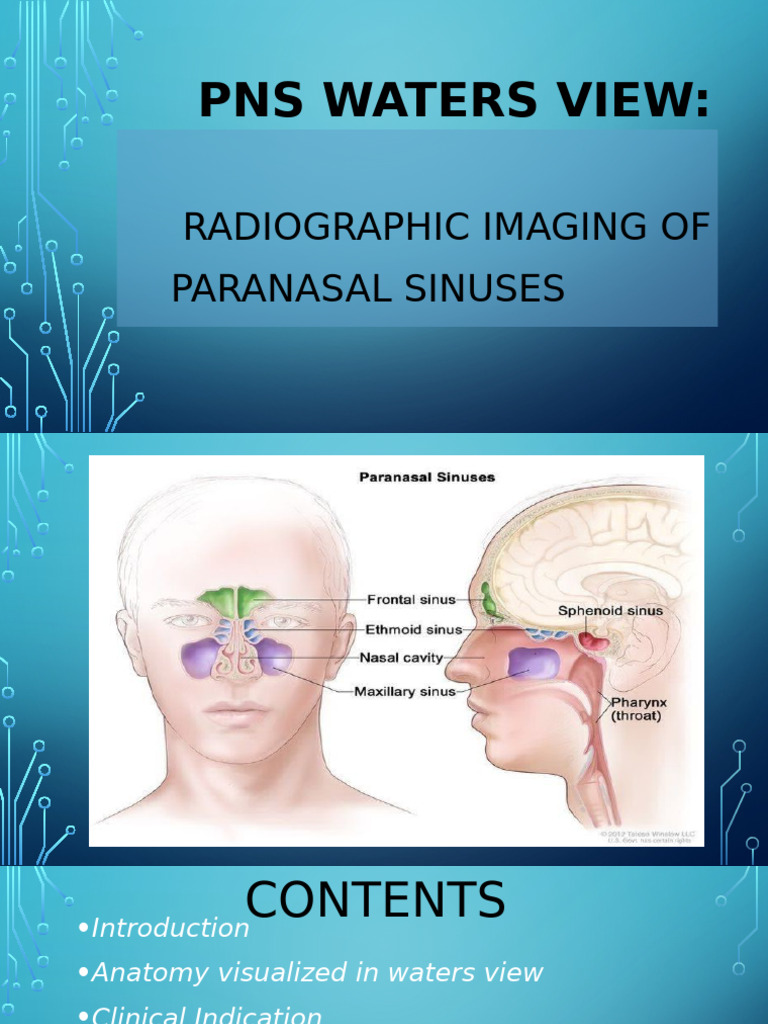 PNS Waters View: Sinus Imaging Guide | PDF | Human Nose | Ct Scan