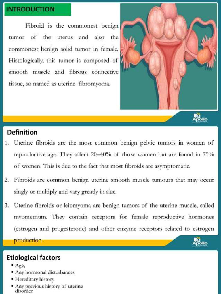 Fibroid Uterus | PDF