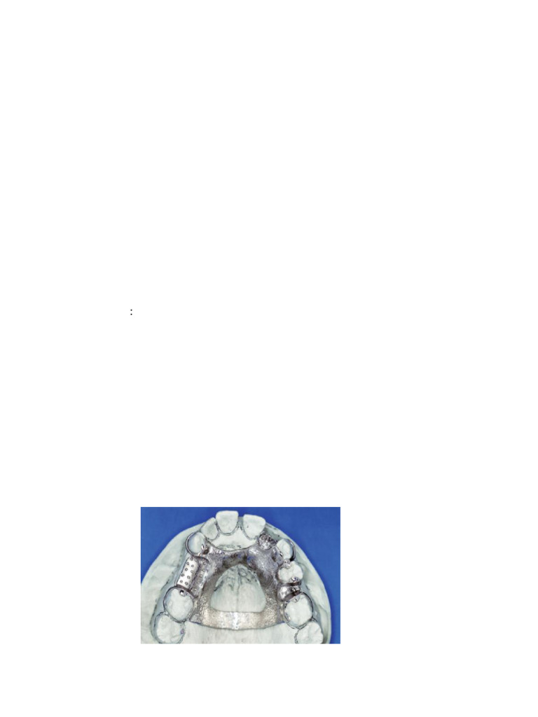 Fitting Removable Partial Denture Framework | PDF | Dentures ...
