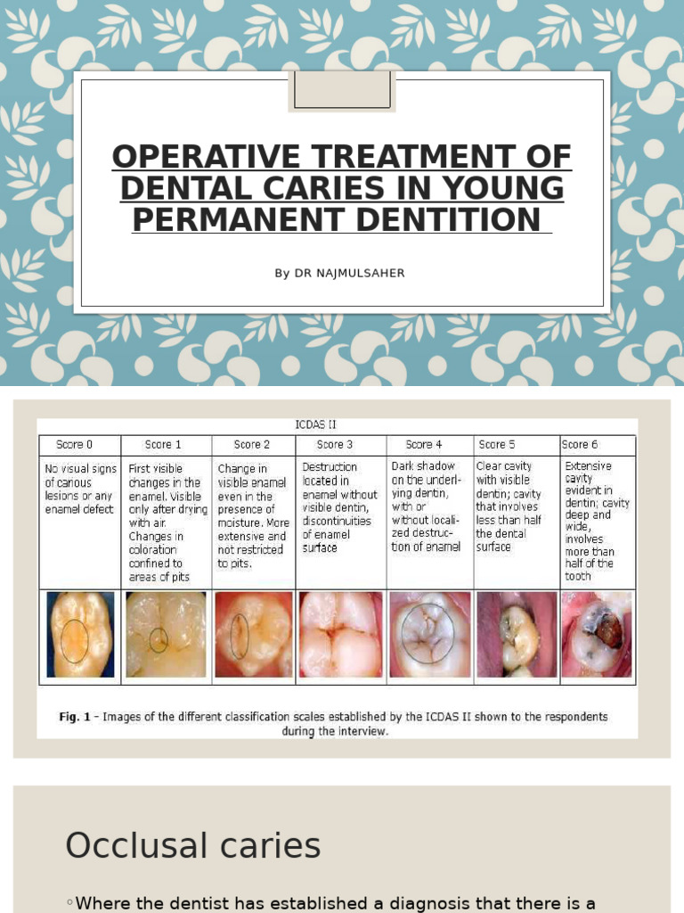 Dental Caries Treatment in Young Teeth | PDF | Dental Composite | Mouth