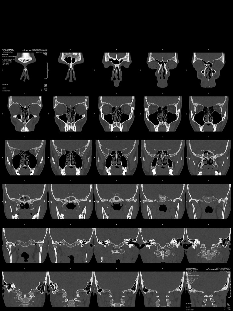 Radiology Film | PDF