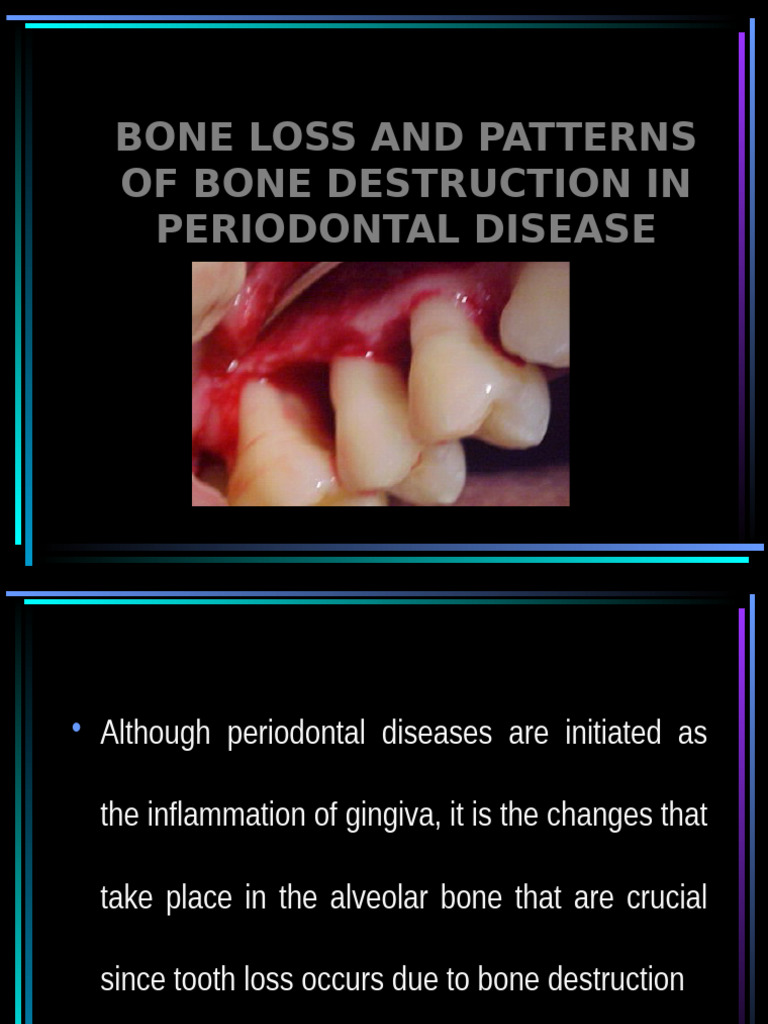patterns-of-bone-loss-in-periodontal-disease-pdf-periodontology-bone