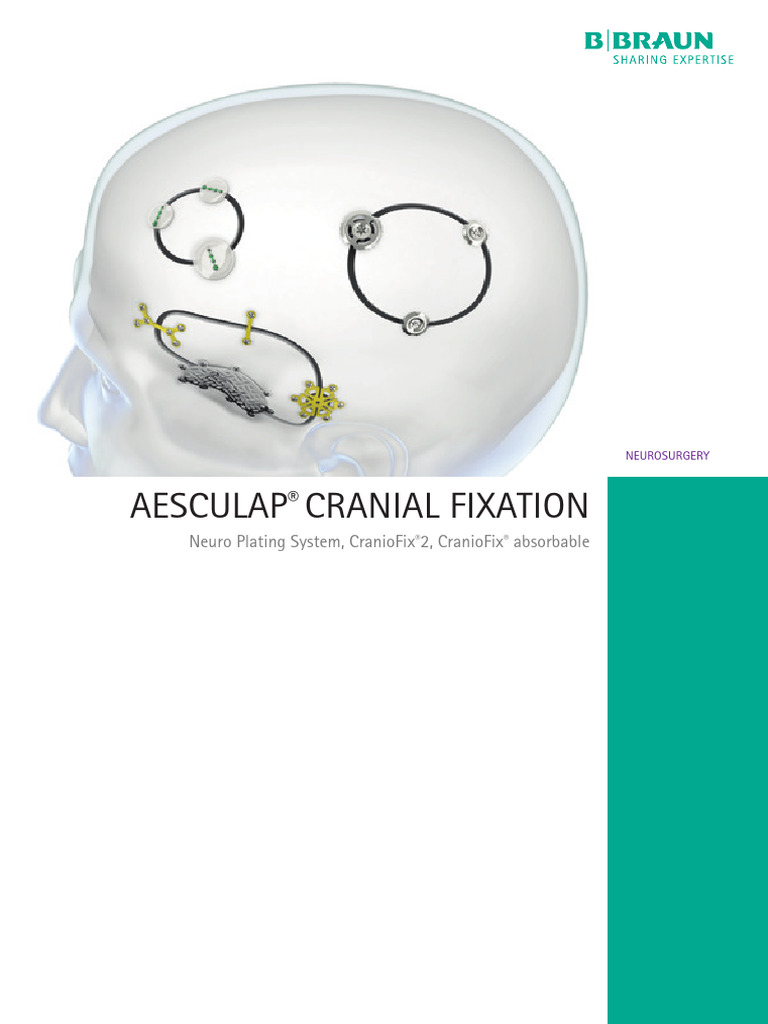 Cranial Fixation Neuroplatingsystemcraniofix2craniofixabsorbable | PDF