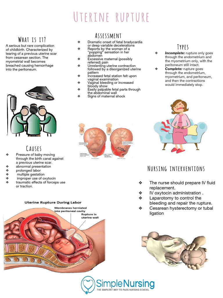 Uterine Rupture | PDF | Childbirth | Medical Specialties