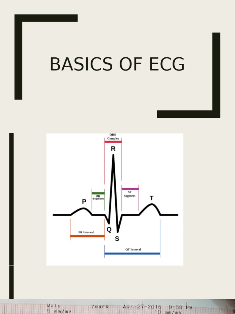 ECG Interpretation Basics Guide | PDF | Electrocardiography ...