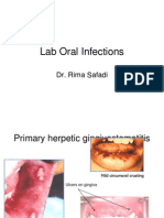 Lab Oral Infections (Lab 4)