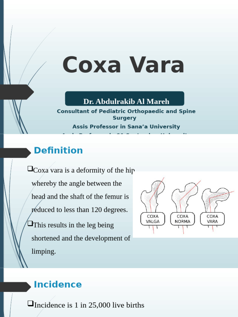 Coxa Vara-Final | PDF