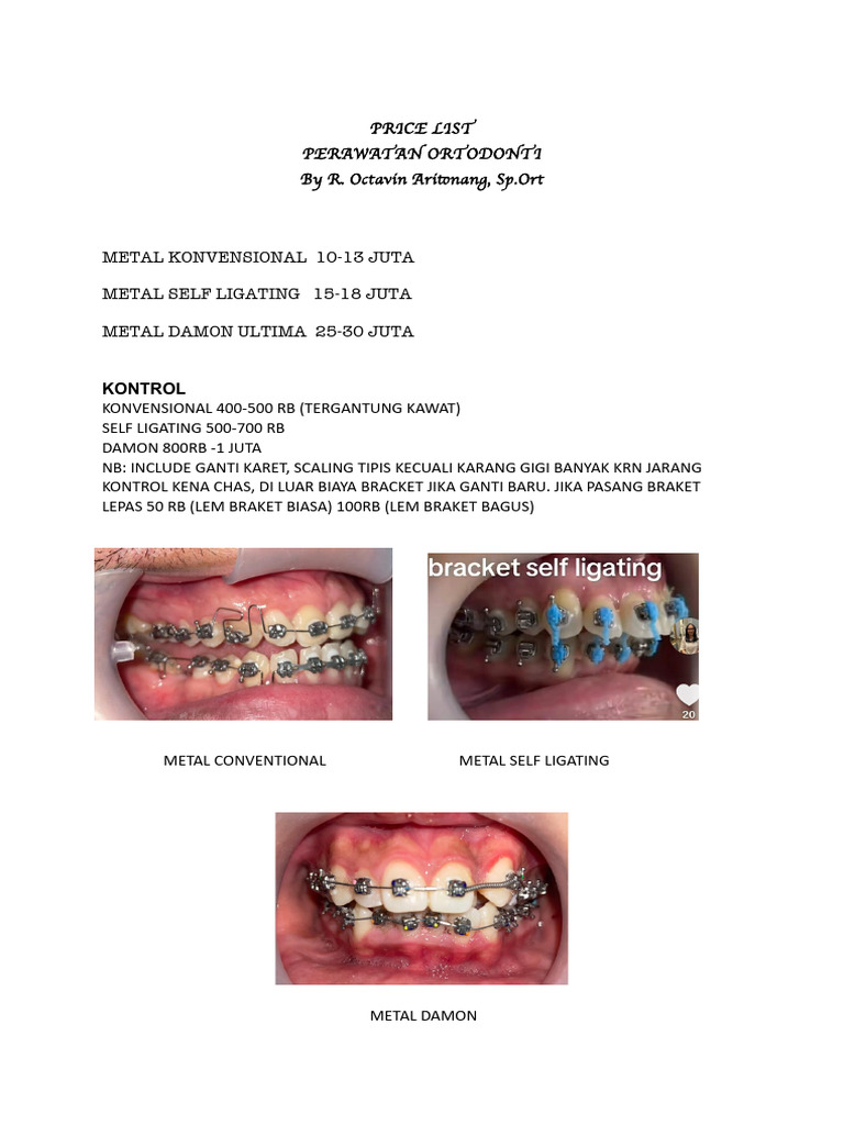 Harga Perawatan Ortodonti Drg. Octavin | PDF