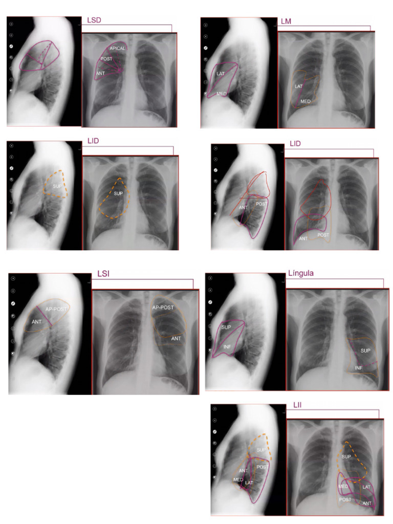 Clase RX | PDF