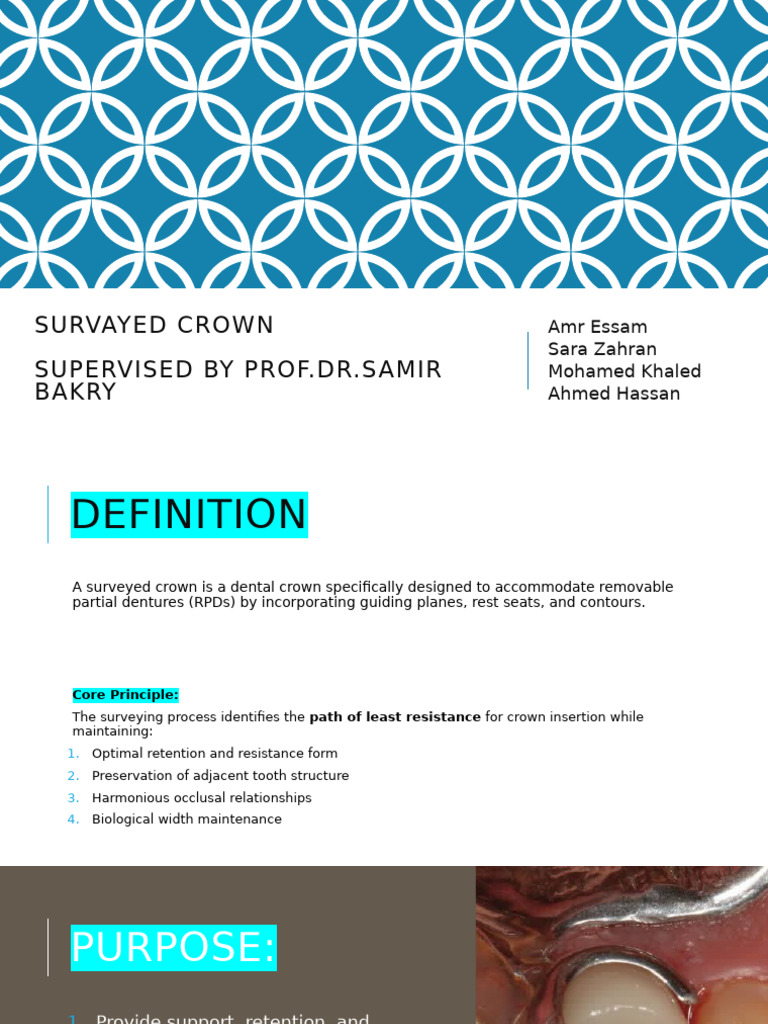 Surveyed Crown for RPD Support | PDF | Dental Anatomy | Mouth