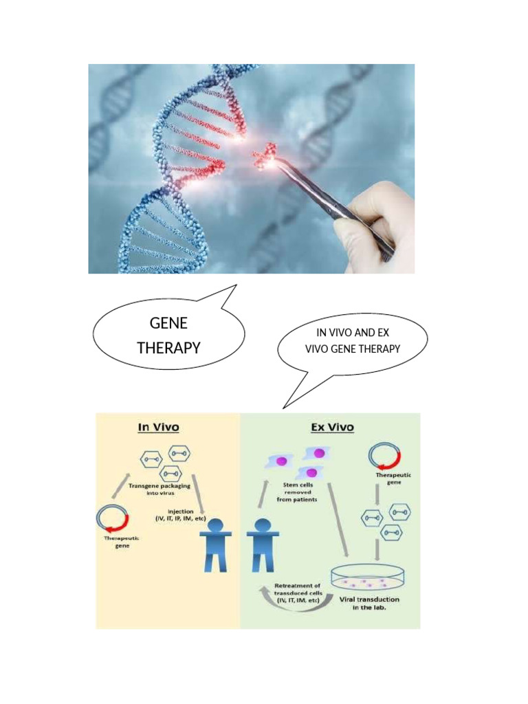 In Vivo and Ex Vivo Gene Therapy Insights | PDF