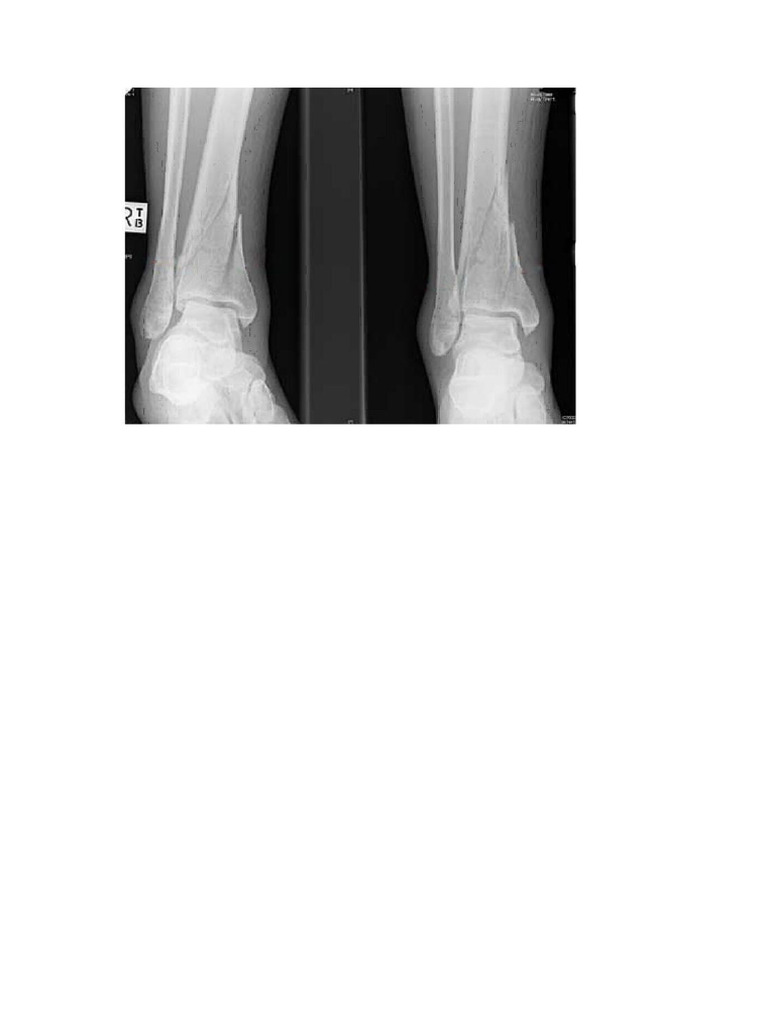 Plain - X - Ray | PDF