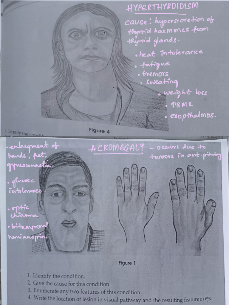 Physiology - Clinical Charts 2 | PDF