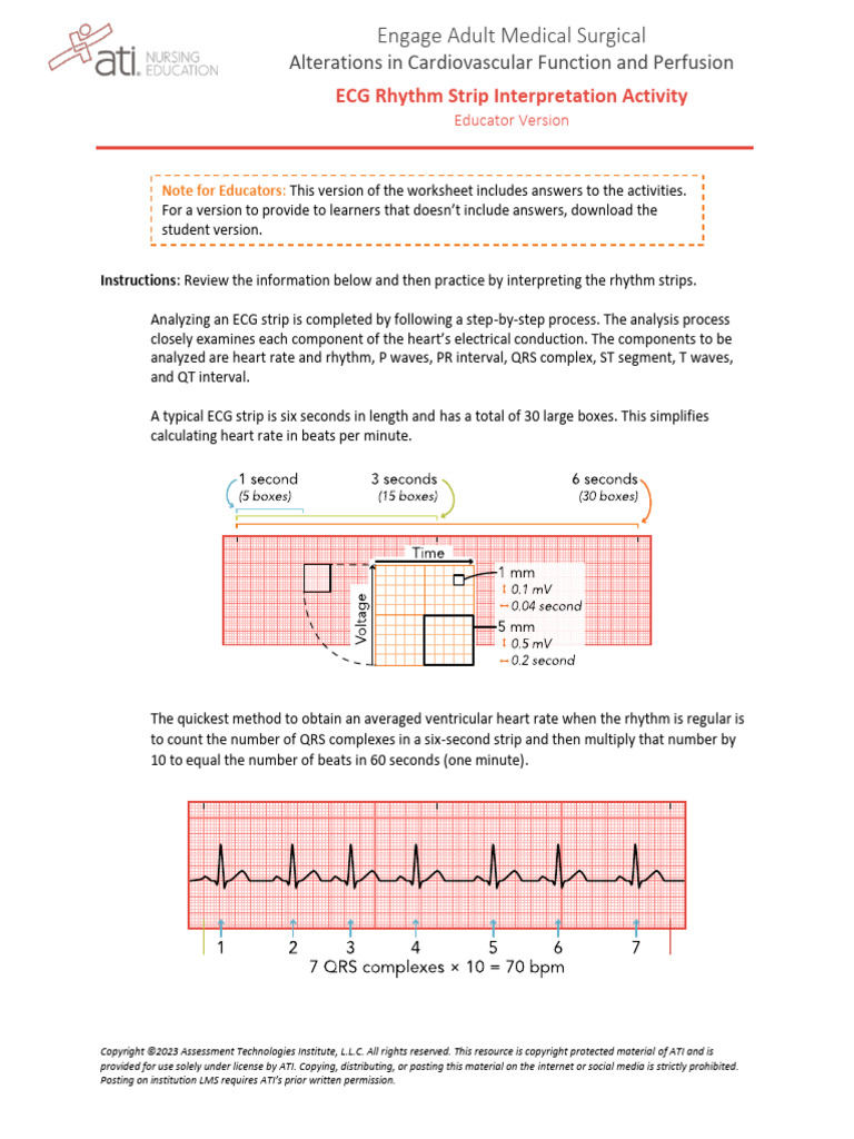 ECG Rhythm Strip Interpretation Guide | PDF | Electrocardiography | Heart