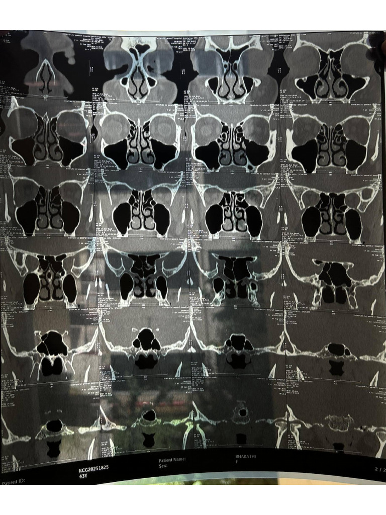 CT Scan | PDF