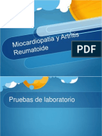 Miocardiopatia