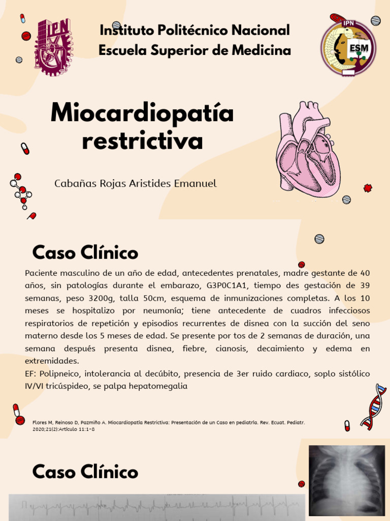 Miocardiopatía Restrictiva | PDF | Medicina Interna | Cardiología