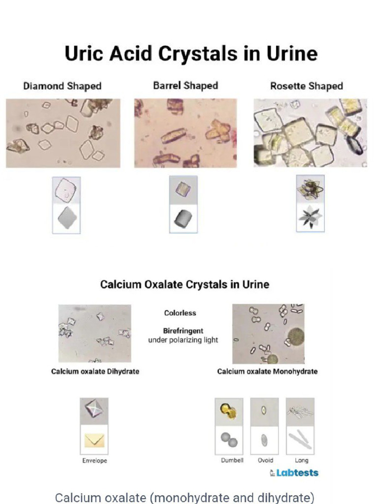 Urine Crystals | PDF