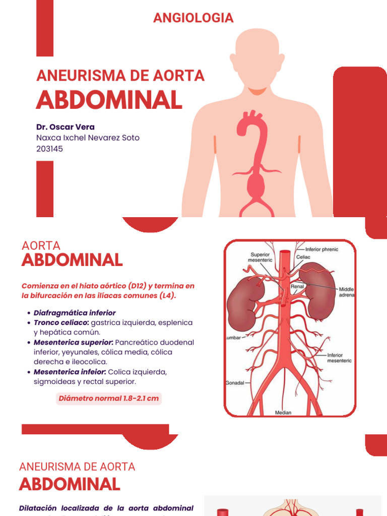 Aneurisma de Aorta: Angiologia | PDF | Angiología | Sistema cardiovascular