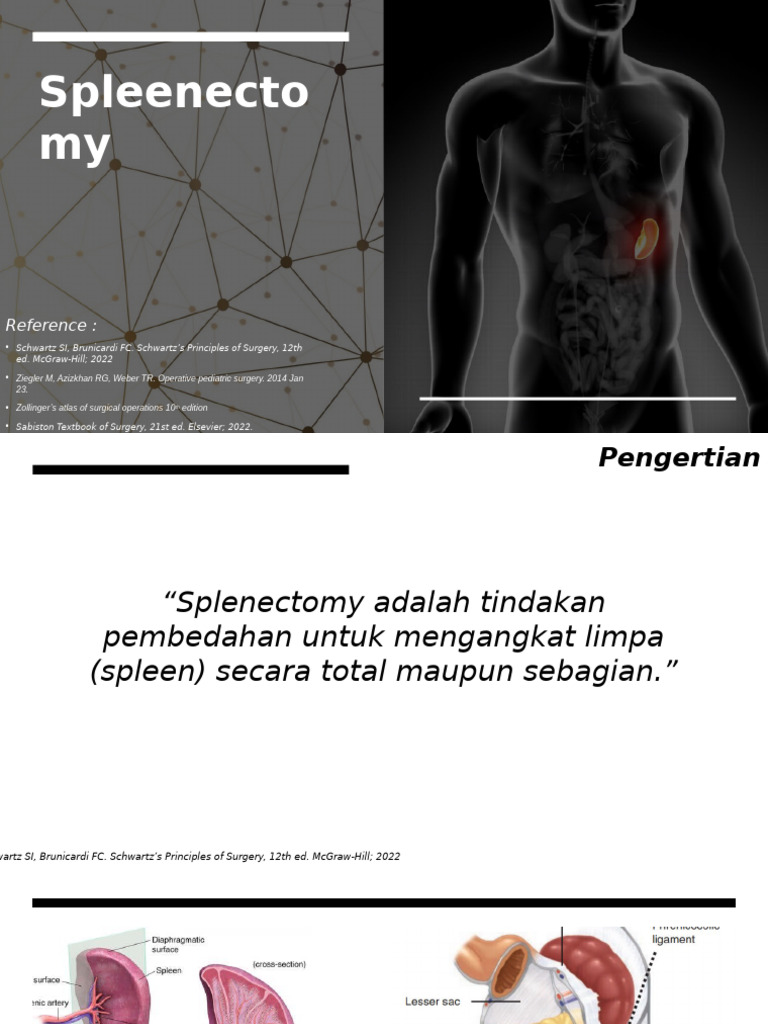Splenectomy: Procedures and Risks | PDF | Thrombosis | Stroke