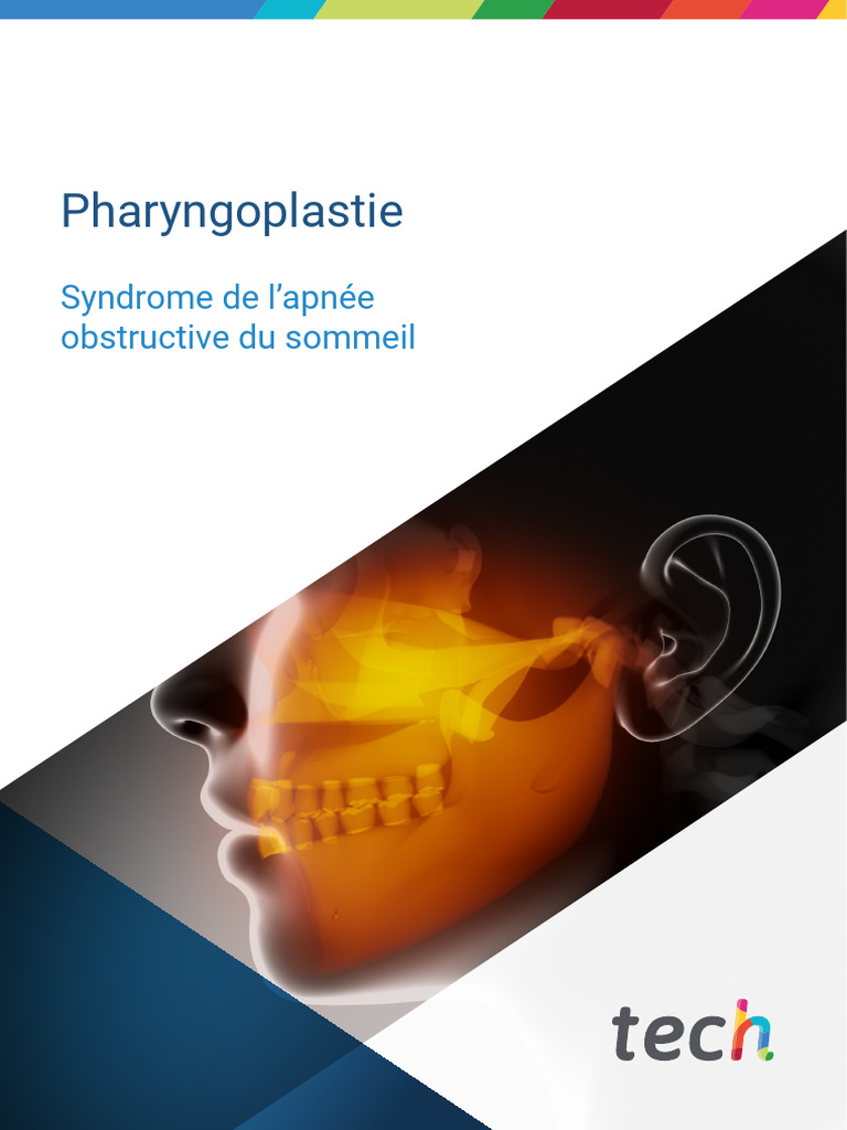 Pharyngoplastie et apnée du sommeil | PDF | Syndrome d'apnées du ...