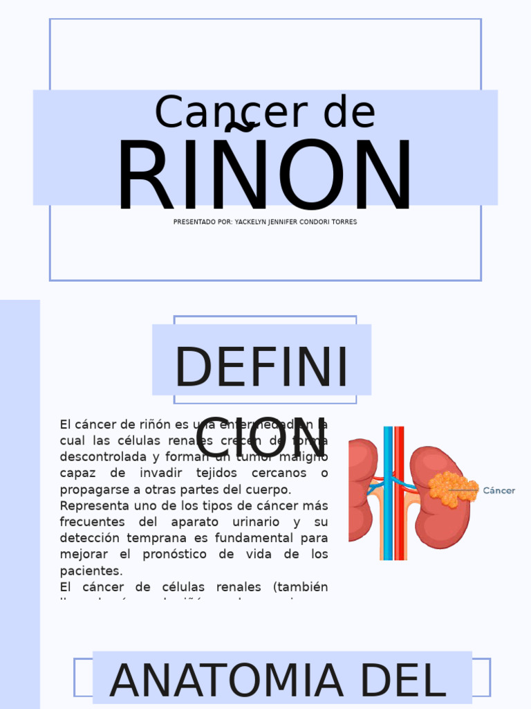 Cáncer de Riñón: Diagnóstico y Tratamiento | PDF | Cáncer | Riñón