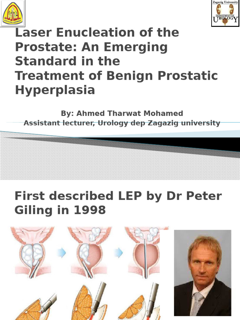 Laser Enucleation of the Prostate an Emerging Standard Ttt - ٠٢٢٣٢٨ ...