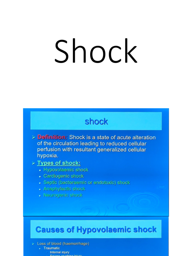 Shock | PDF