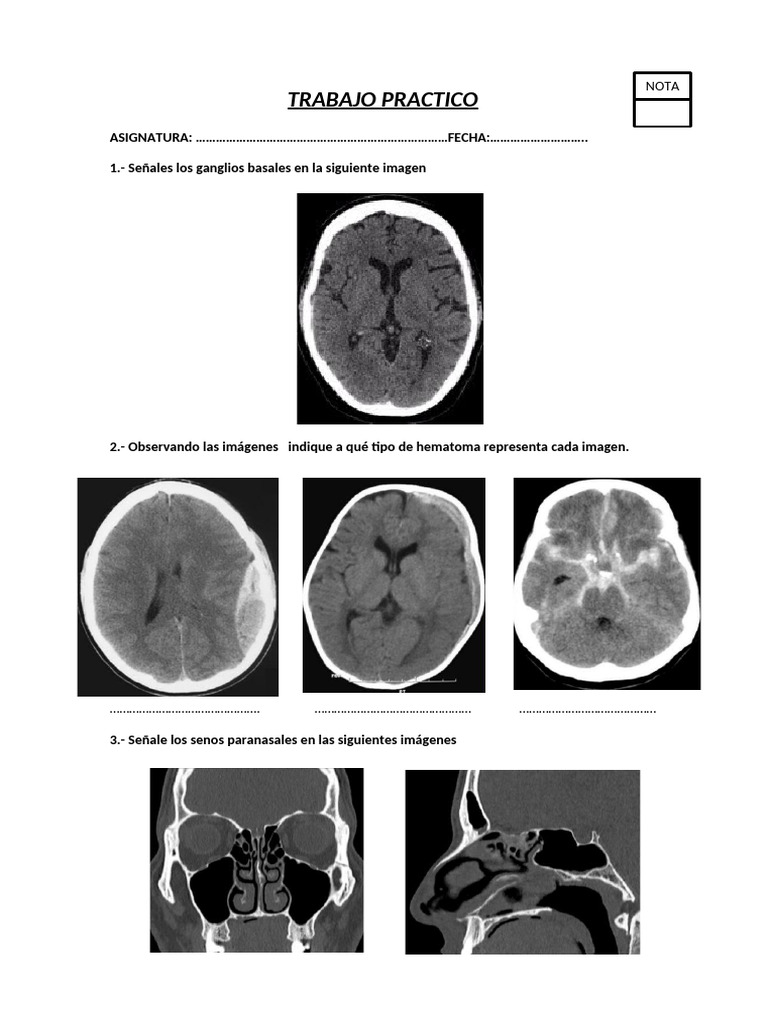 Práctica de Anatomía y TC en Imágenes | PDF