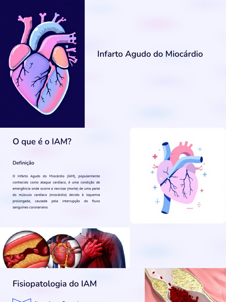 Infarto Agudo do Miocárdio: Causas e Tratamento | PDF | Infarto do ...