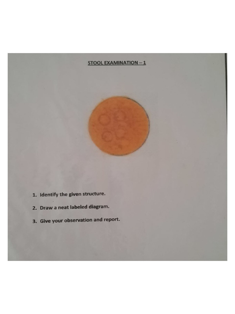 Stool Examination Different Infectious Agents Seen Under Microscope | PDF
