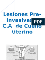 Lesiones Pre-Invasivas y C.A Cuello Uterino
