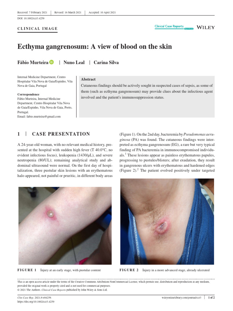 Ecthyma Gangrenosum A View of Blood On The Skin | PDF | Diseases And ...