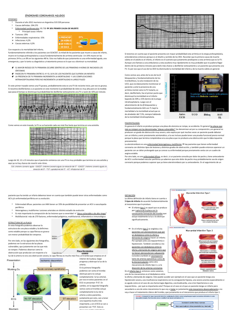 Mortalidad y Manejo del Infarto Agudo | PDF | Infarto de miocardio ...