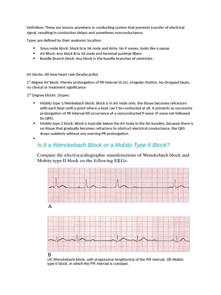 Understanding AV Block Types in ECG | PDF | Cardiac Arrhythmia | Heart