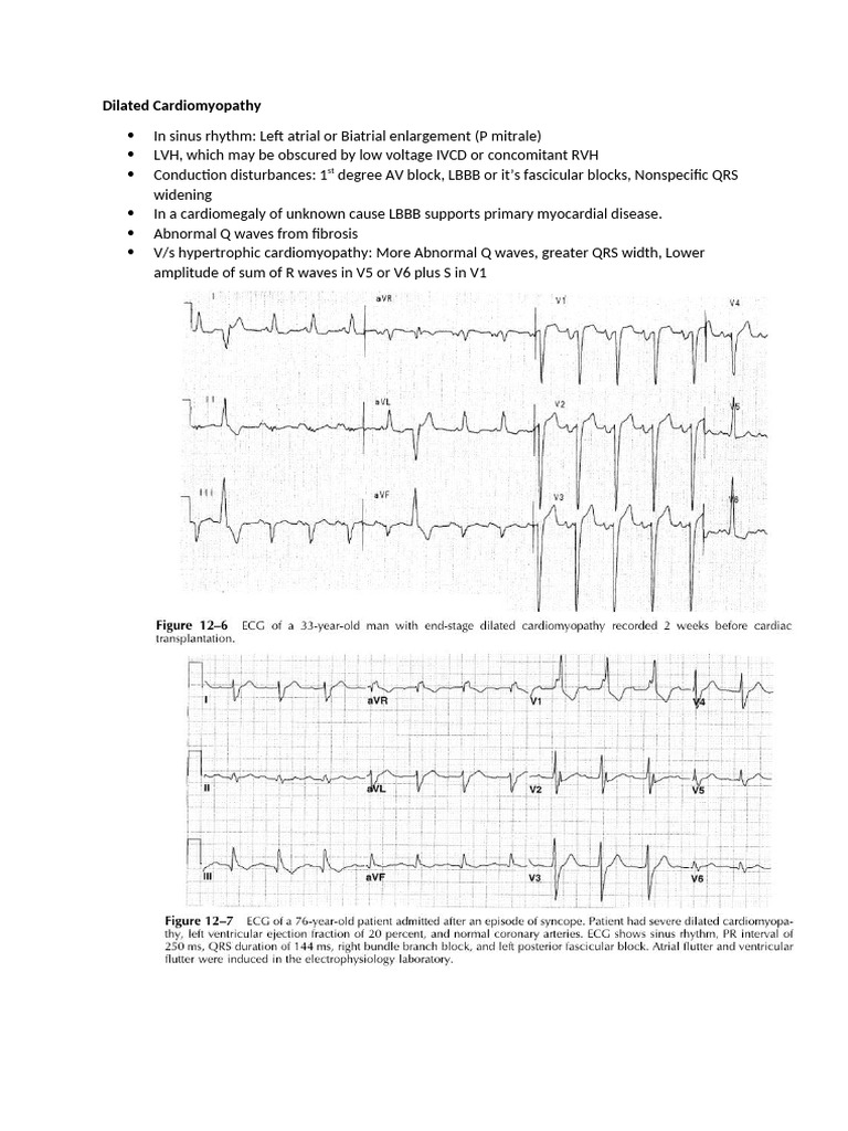 ECG Changes in Heart Disease Other Than Ischemia | PDF ...