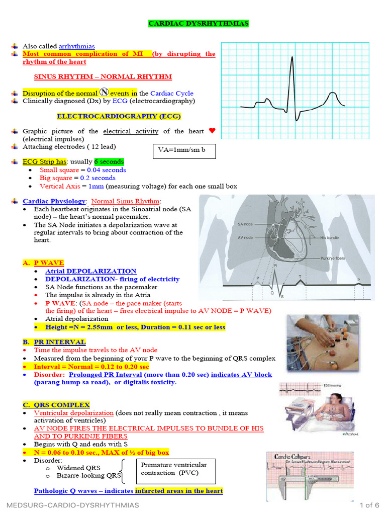 Understanding Cardiac Dysrhythmias | PDF | Electrocardiography | Heart