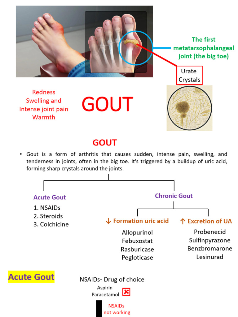 Understanding Gout: Symptoms and Treatments | PDF | Gout | Drugs