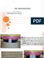 Encerado de Dentaduras